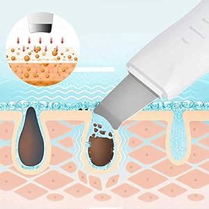 Aravli Ultrasonic Ion Skin Peeling Blackhead Remover Facial Massager ...
