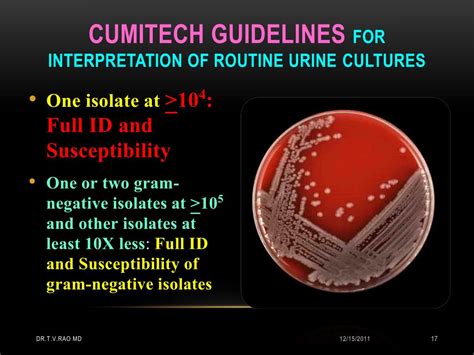 Urine Culture Mixed Gram Positive And Negative Flora at Adela Spooner blog
