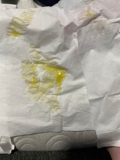 In the last ten minutes my snot has turned neon yellow : r/medical_advice