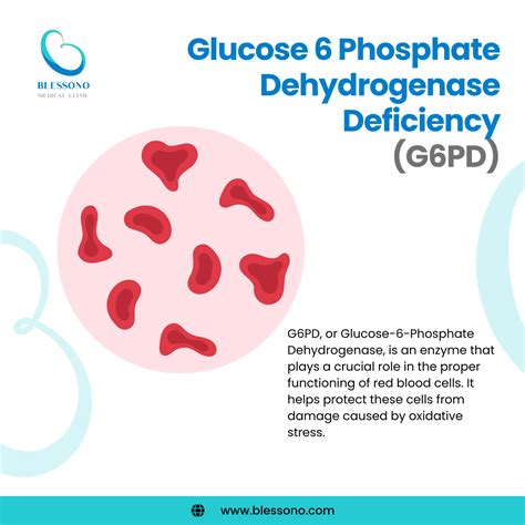 G6PD Deficiency: Symptoms and Management