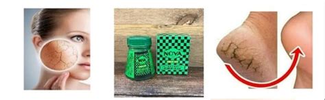 NOVA CREAM Ayurvedic Cream 16 gm (Pack of 3) : Amazon.in: Beauty