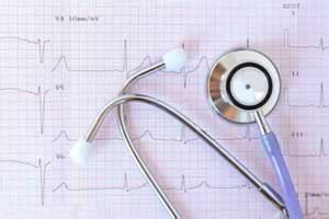 Rare presentation of Fabry disease as ventricular tachycardia: EHJ Case ...