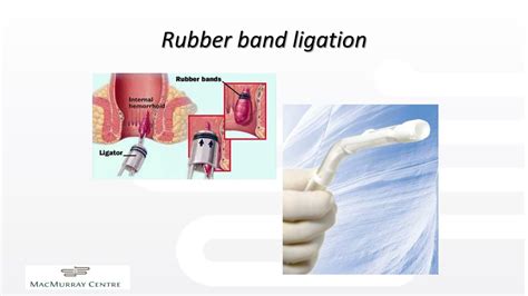 PPT - Common perianal conditions PowerPoint Presentation, free download ...