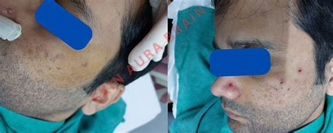 Best Dermatologist in Delhi | Skin Aura Brain