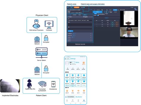 Image result for Solidremote Programming