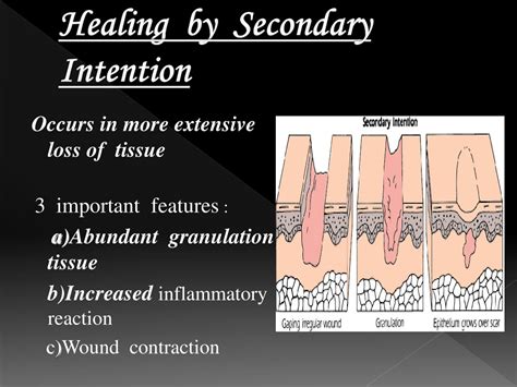 PPT - Comprehensive Classification of Wounds for Effective Treatment ...