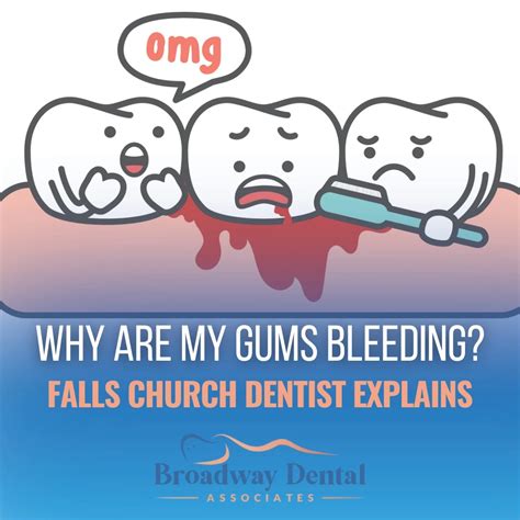 Why Are My Gums Bleeding? | Falls Church Dentist Explains