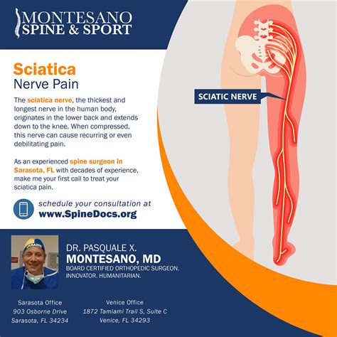 Sciatica Nerve Pain - Spine Docs