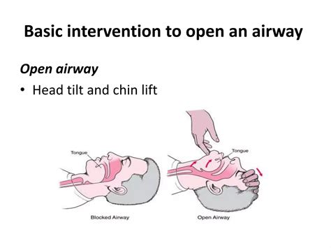 Basic Airway management.pptx