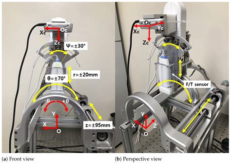 A Sarcopenia Detection System Using an RGB-D Camera and an Ultrasound ...