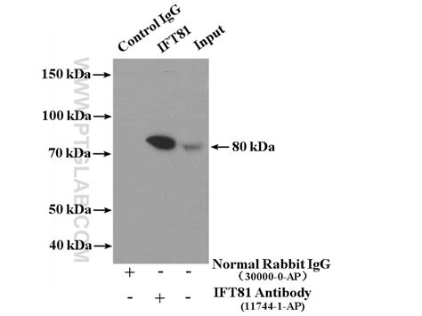 IFT81 antibody (11744-1-AP) | Proteintech