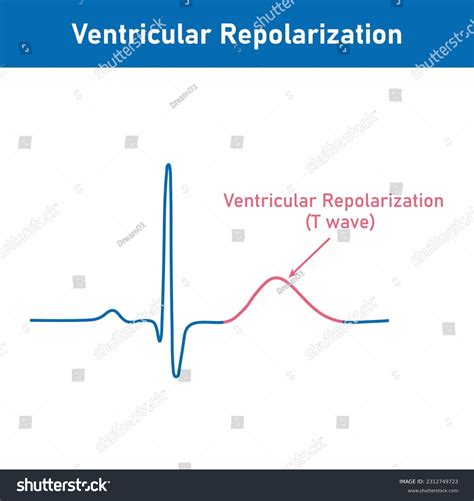 Repolarization Of The Heart