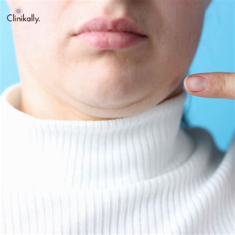 Obesity and Skin Health | Clinikally