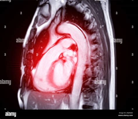 What Does A Cardiac Mri Cost at Ronald Caster blog