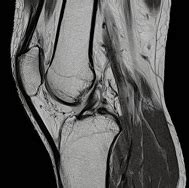 PREM SCANS - Perfect Diagnosis
