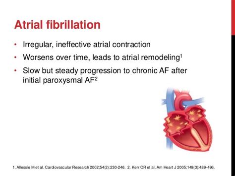 Atrial Fibrillation 的图像结果