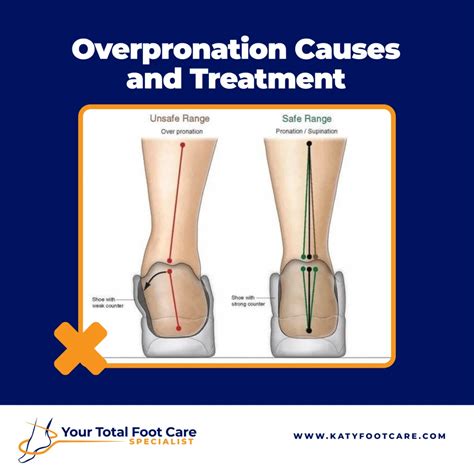 Foot Pronation