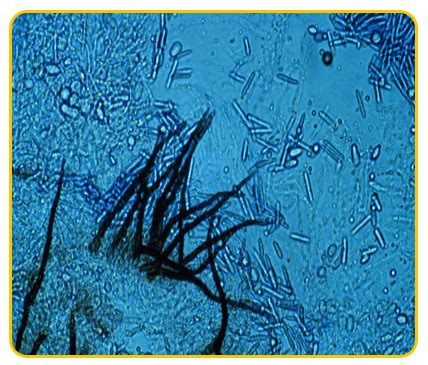 Banana Expert System