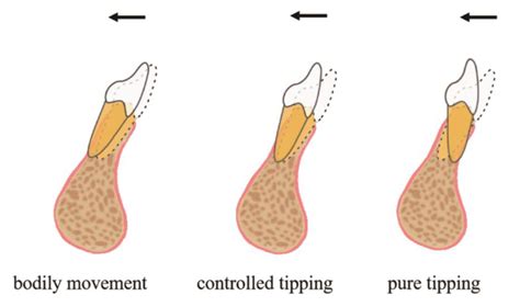 Drugs Affecting Tooth Movement at Kenneth Neilson blog