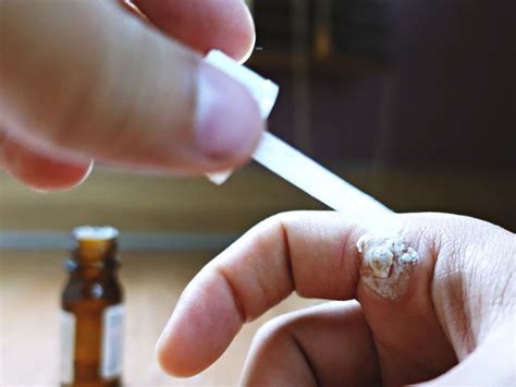 apa manfaat obat asam folat