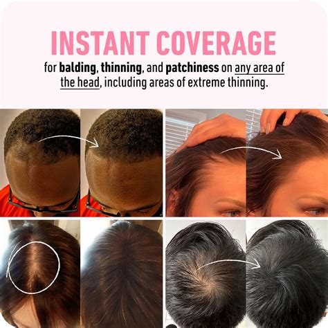 BOLDIFY Hairline Powder Instantly Conceals Hair India | Ubuy