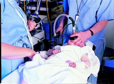Pediatric Anesthesia 的图像结果