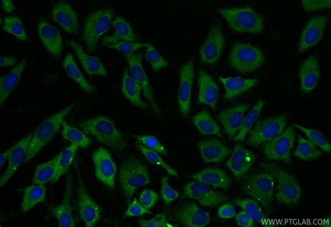 RBP4 antibody (11774-1-AP) | Proteintech