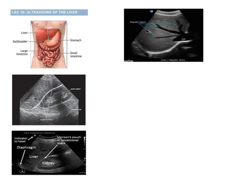 Abdomen - Image - Radiologic Technology - ABDOMINAL AORTA ABDOMEN ...