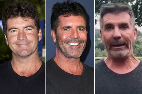 Simon Cowell's face, then and now: His transformation in photos