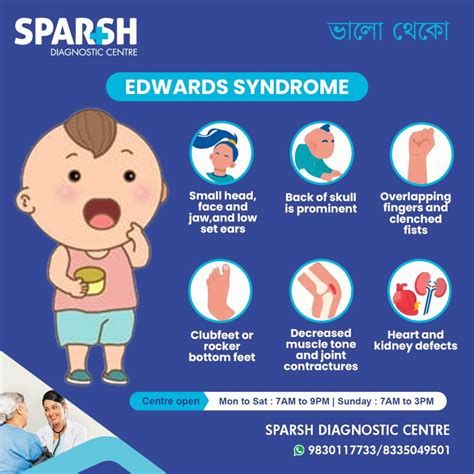 Edwards Syndrome (Trisomy 18) - Sparsh Diagnostic Center