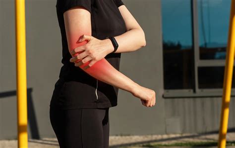 Elbow Dislocation Recovery Timeline & Treatment