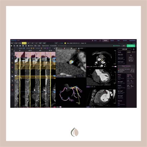 Cleerly | Heart Scan - Ananda Integrative Medicine