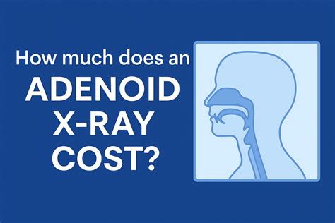Meniere's disease audiogram