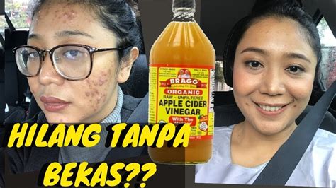 manfaat cuka apel untuk gula darah
