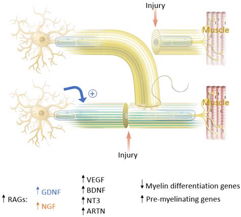 Surgical Coaptation Techniques in Peripheral Nerve Injuries ...
