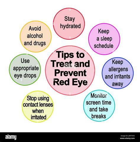 Tips to Treat and Prevent Red Eye Stock Photo - Alamy