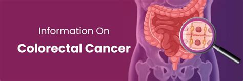 Key Information on Colorectal Cancer in Hyderabad