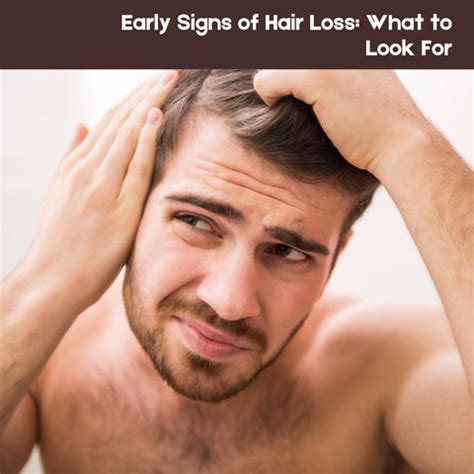 M-Shaped Hairline: Is It a Warning Sign of Balding? | Clinikally