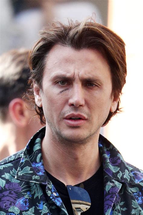 Ouch! Jonathan Cheban Caught With Nasty Bruise Under His Eye