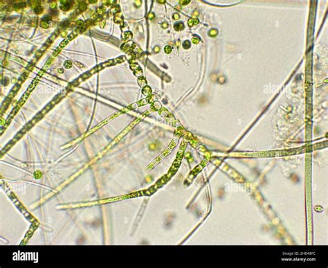 Blue Green Algae Under Microscope
