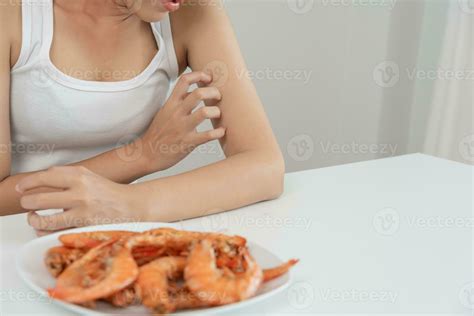 food allergies, women have reactions itching and redness after eating ...