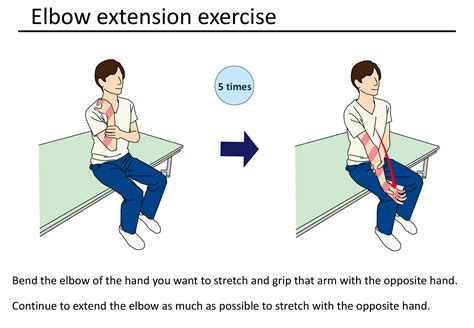 Elbow | Physio Visuals: Illustrated Exercise, Stretching, and Rehabilitation Guides