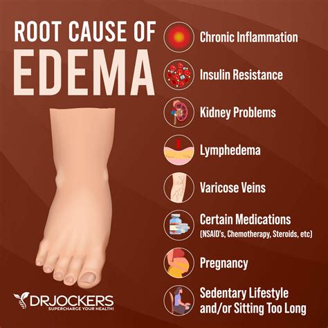 Edema: Symptoms, Causes, and Natural Support Strategies