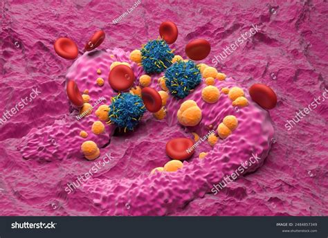Basal Cell Melanoma: Over 195 Royalty-Free Licensable Stock Illustrations & Drawings | Shutterstock