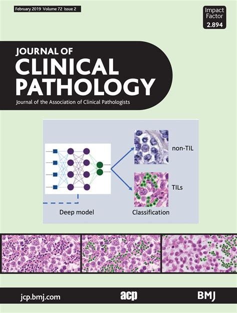 JAK2-tree: a simple CBC-based decision rule to guide appropriate JAK2 ...