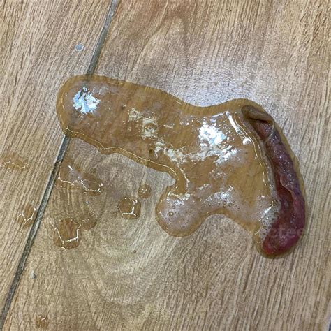Vomit On Floor