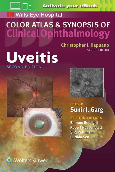 Buy Uveitis (Color Atlas & Synopsis of Clinical Ophthalmology) Book ...