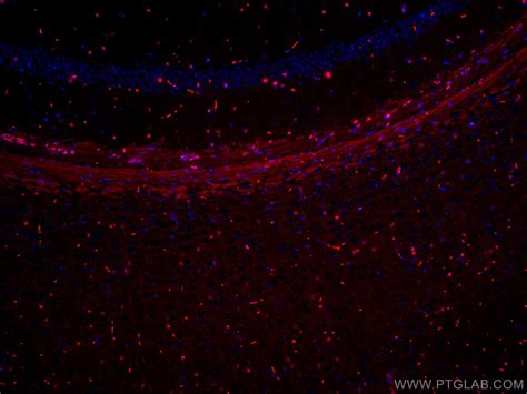 SOX2 antibody (CL594-66411) | Proteintech