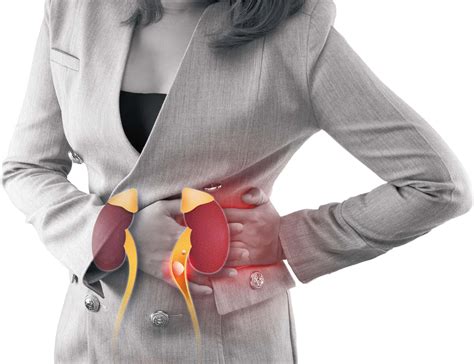 Kidney stones: From agony to action - Harvard Health