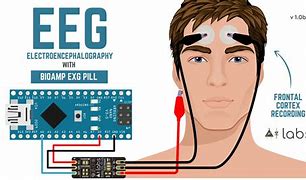 Image result for electroencephalograph